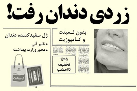 ارزش روز سهام عدالت ۵۳۴ هزار تومانی چقدر شد؟ 2 فرصت ویژه 45٪ تخفیف! دندانهاتو مثل کامپوزیت سفید کن!